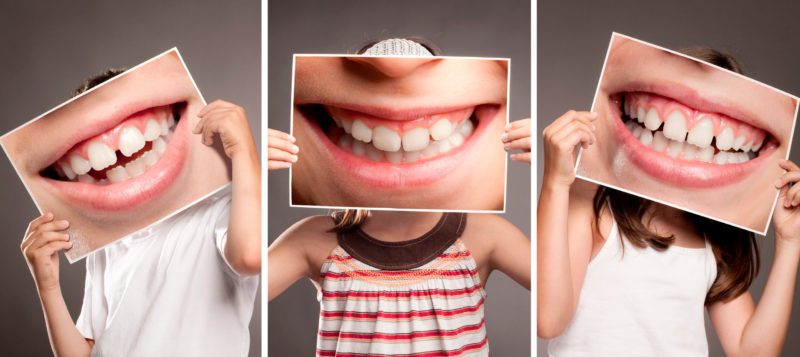 grupo de niños sosteniendo una foto de la boca sonriendo mostrando sus dientes